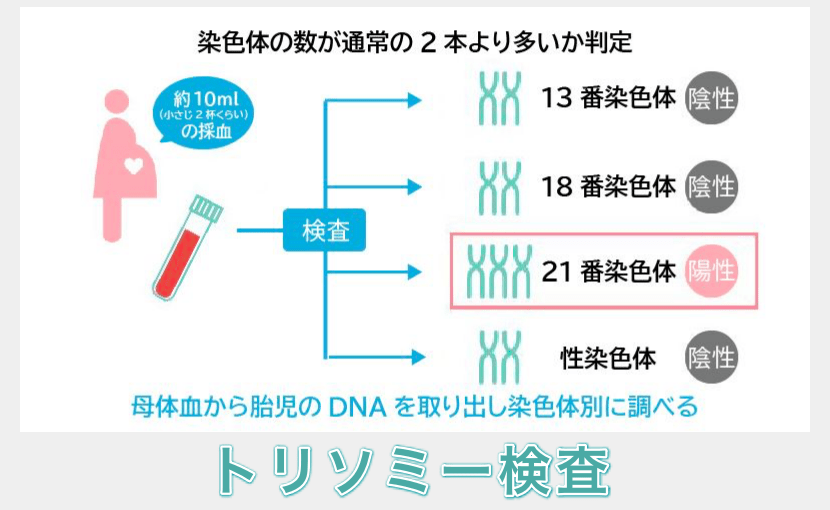  NIPTのトリソミー検査